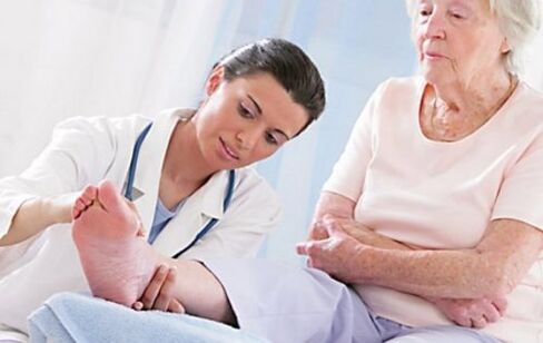 Navštívte lekára, ak máte príznaky kŕčových žíl